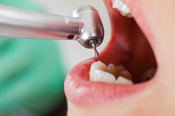 Best Emergency Treatment for Dental Infections or Abscesses in Winner, SD